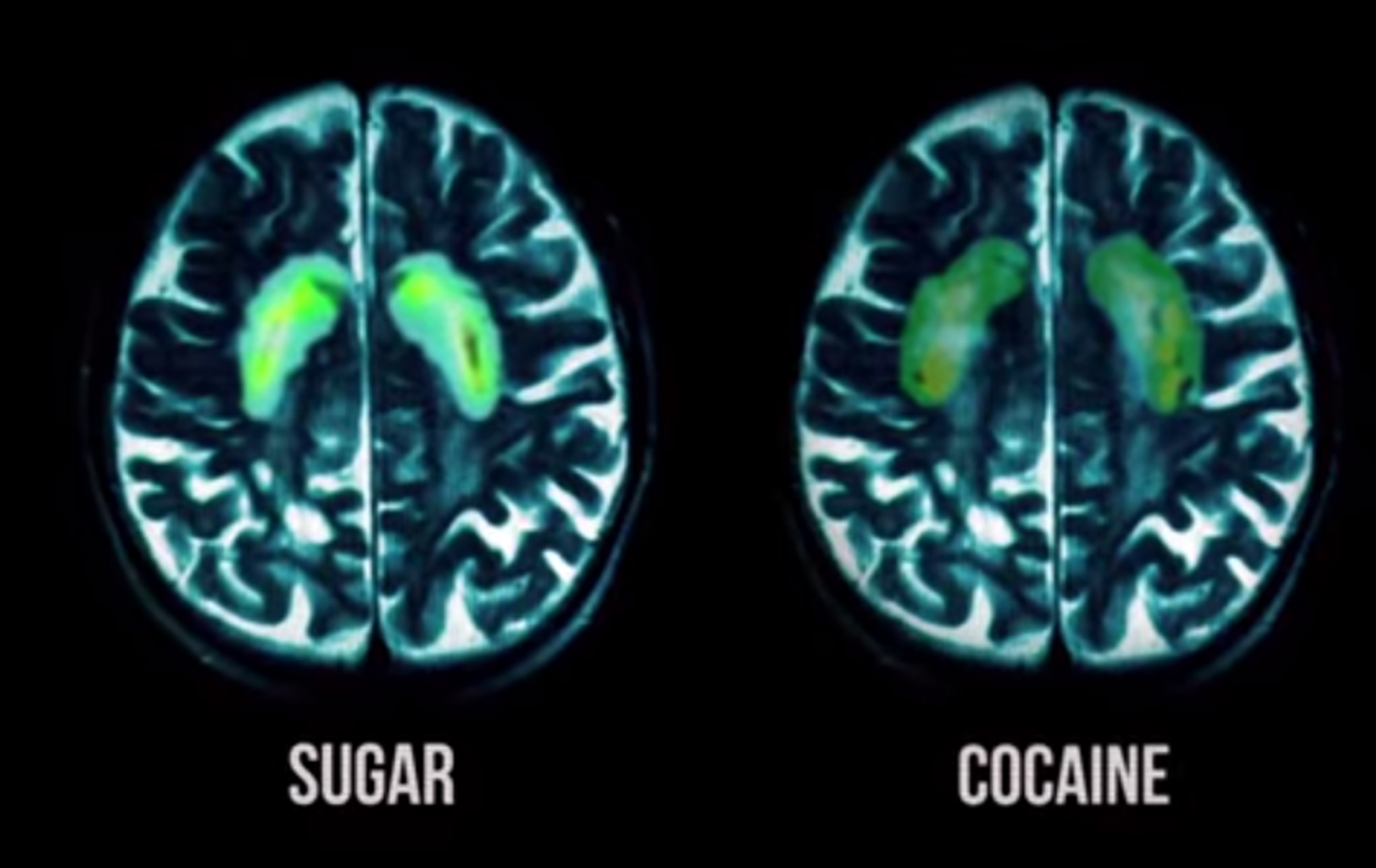 sugar cocaine